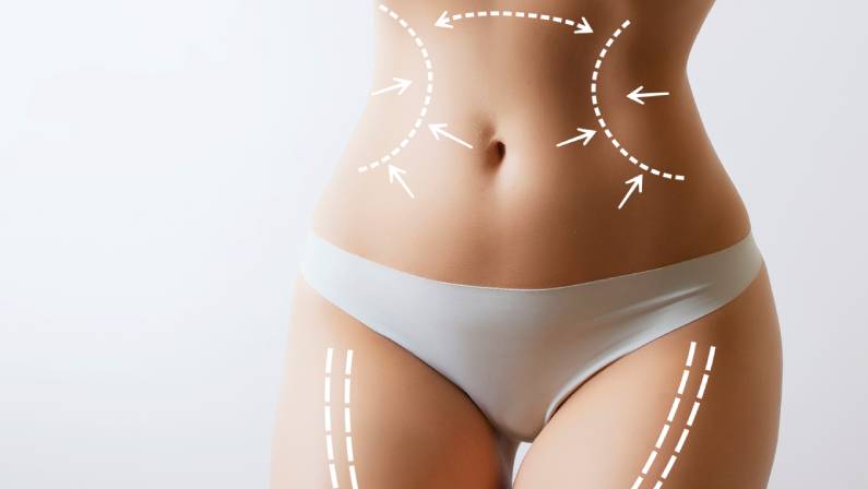 how safe is liposuction