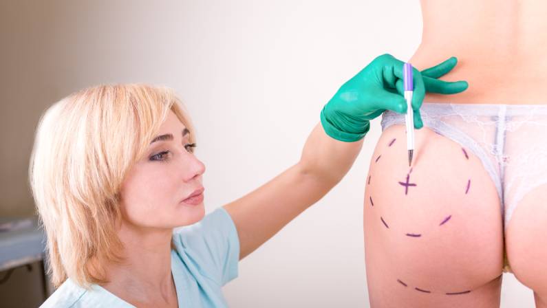 Surgeon drawing marks on female body before plastic operation
