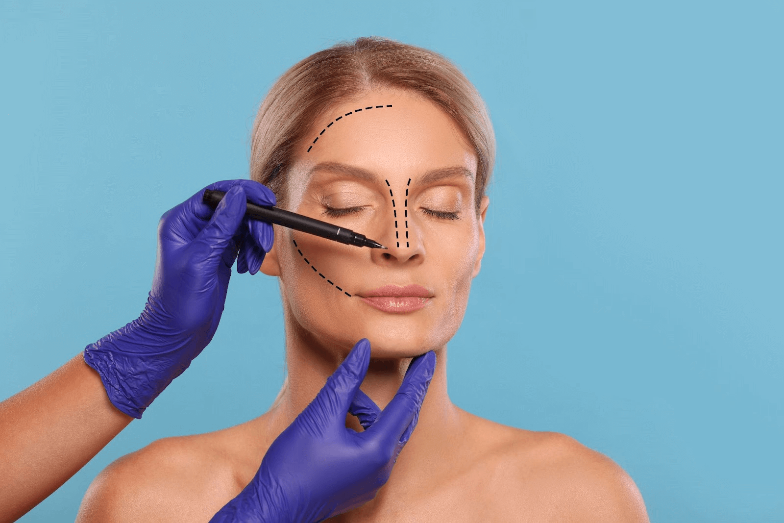 Rhytidectomy Cost: Factors & Inclusions of a Facelift Investment