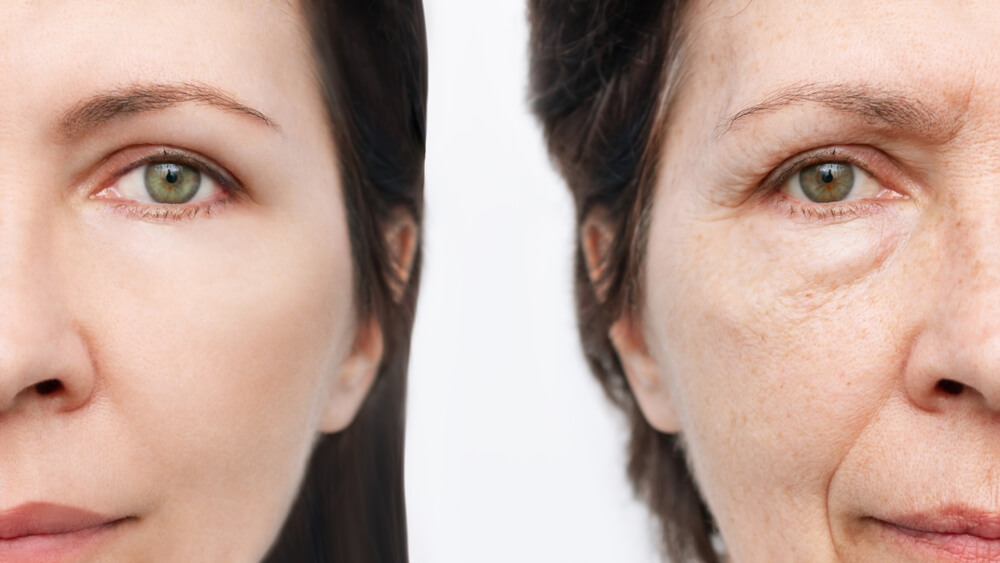 Age-related changes, appearance of wrinkles 