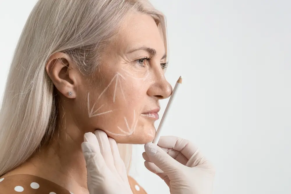 Thread facelift, concept of lifting skin.